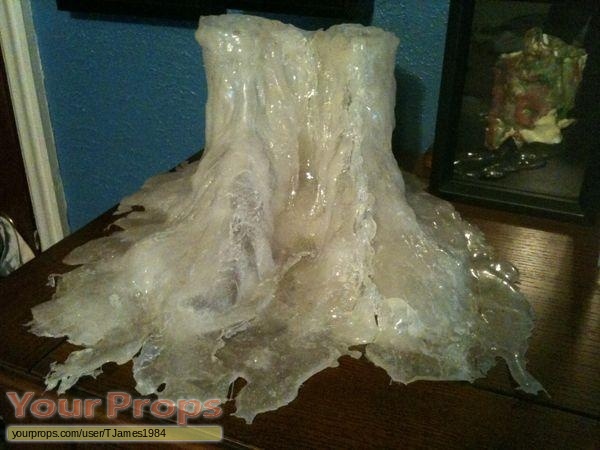 This is the "frozen feet" prosthetic used in the freezer where &q...